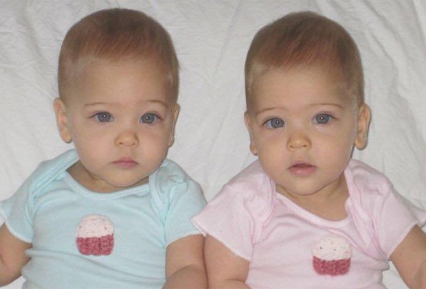 They were labelled the 'world's most beautiful twins' as babies - 8 years  on, look at them now! | Practical Parenting Australia