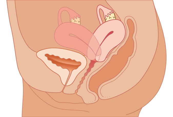 Cross section biomedical illustration of retroverted uterus/Getty Images