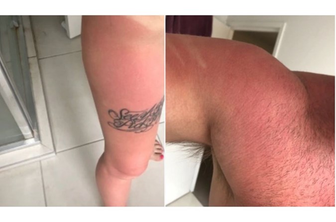A sunscreen sold at ALDI has been called "acid" by buyers after many complained of "burning to a crisp" after applying. Credit: Supplied