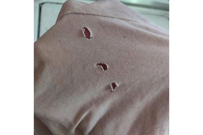 Where Stone stabbed me through the shirt. Image: That's Life