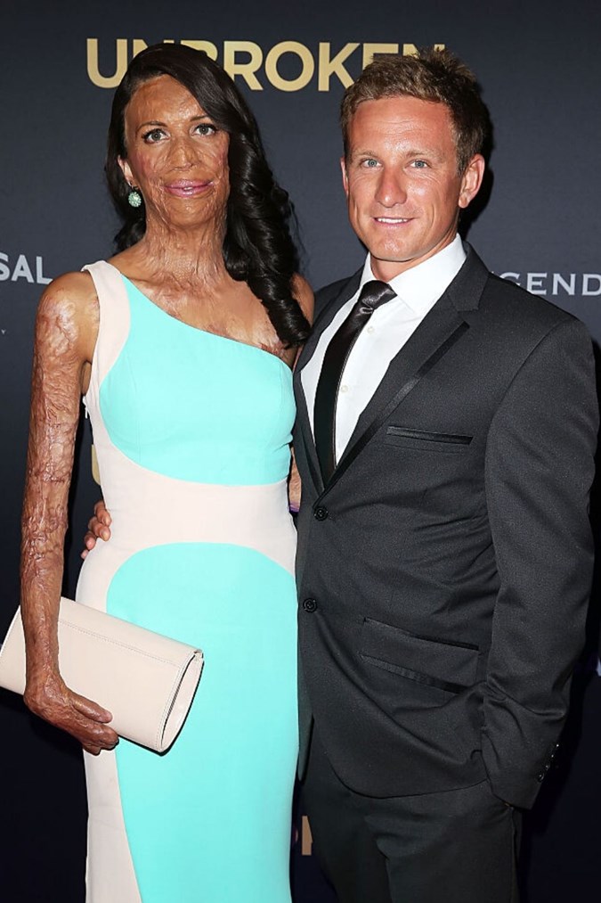 Australian burns survivor Turia Pitt and partner Michael Hoskin have welcomed their second child into the world, a baby boy named Rahiti. Image: Getty
